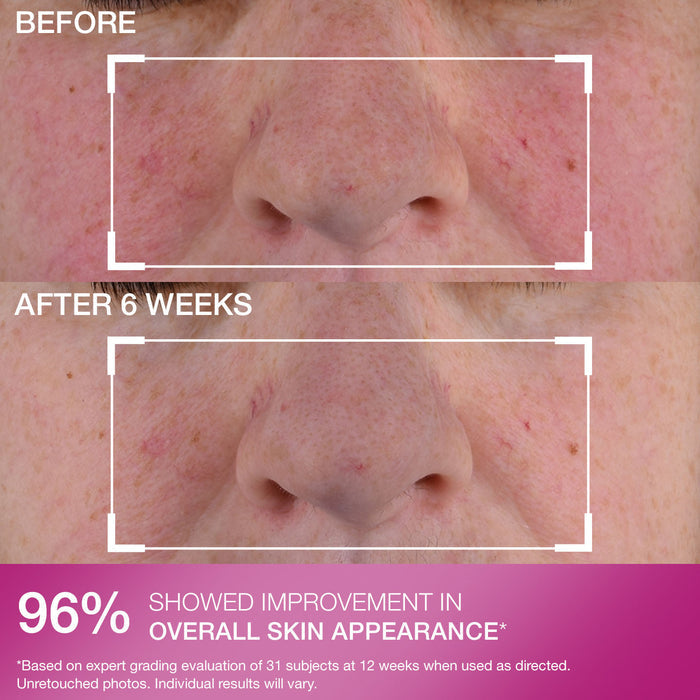 Advanced Retinol Nightly Multi-Correct Serum