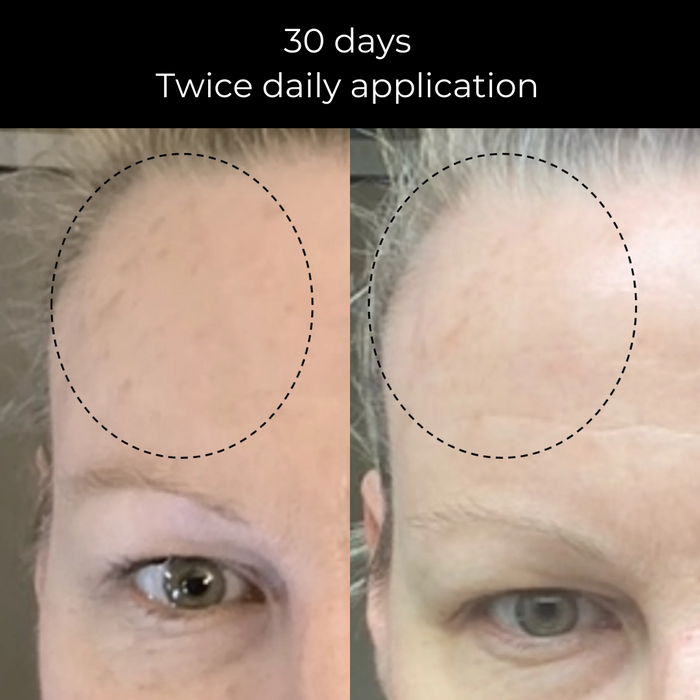 Brightening Trio Advanced -