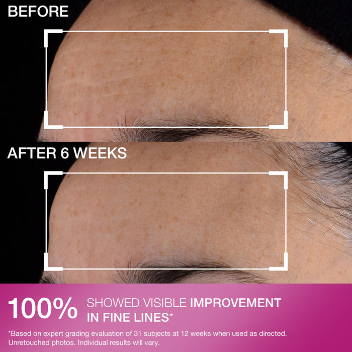 Advanced Retinol Nightly Multi-Correct Serum