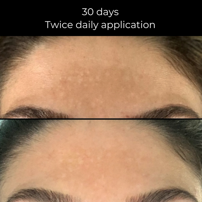 Brightening Trio Advanced -
