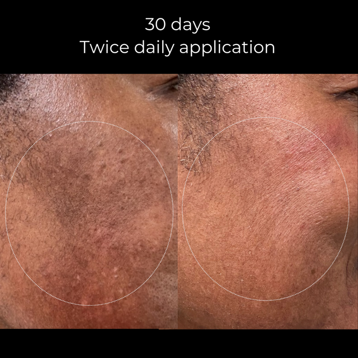 Brightening Trio Advanced -