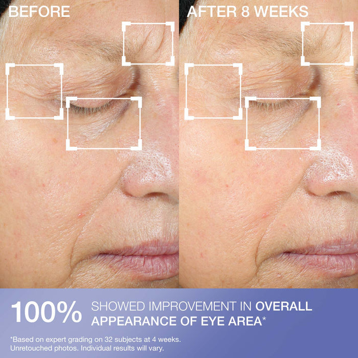Intensive Eye Concentrate for Wrinkles PLUS