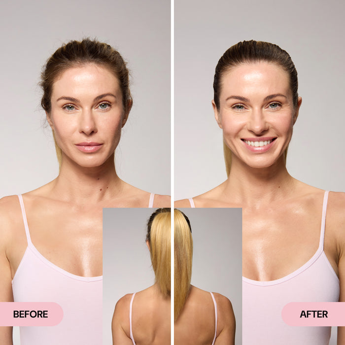 before and after