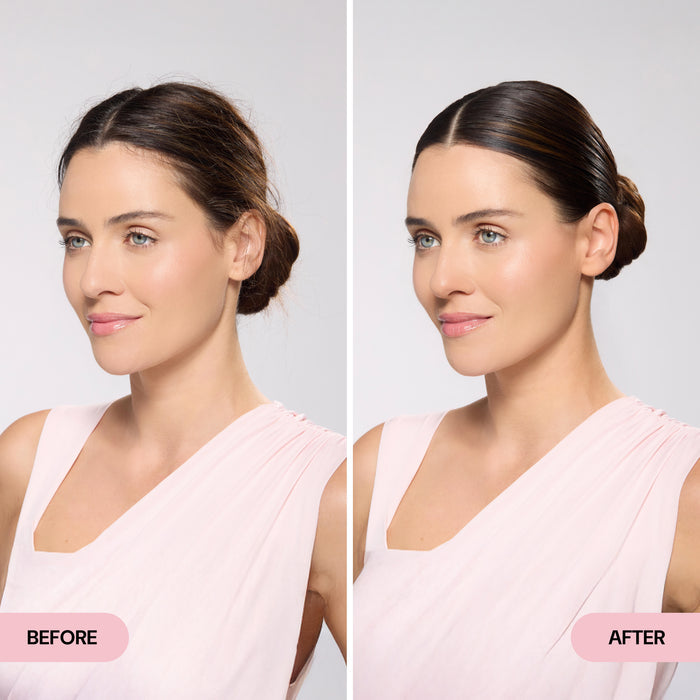 before and after