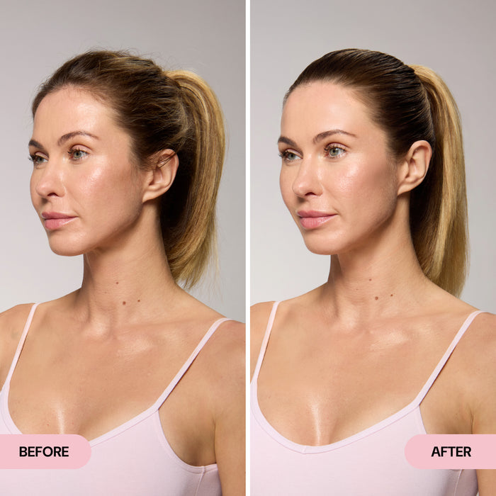 before and after
