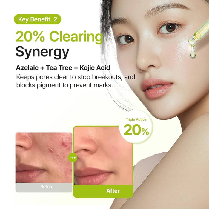 Purito Azelaic Acid 10 Kojic Tea Tree Serum 30ml سيروم شجرة الشاي الكوجيك بحمض الأزيليك 10 من بوريتو - Princess Cosmetics Qatar