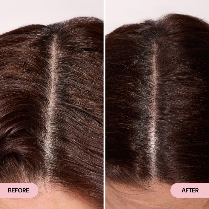 before and after