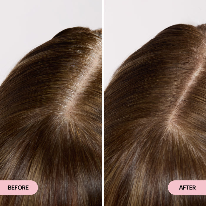 before and after
