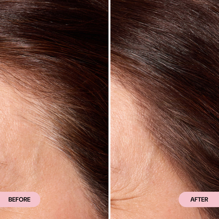 before and after