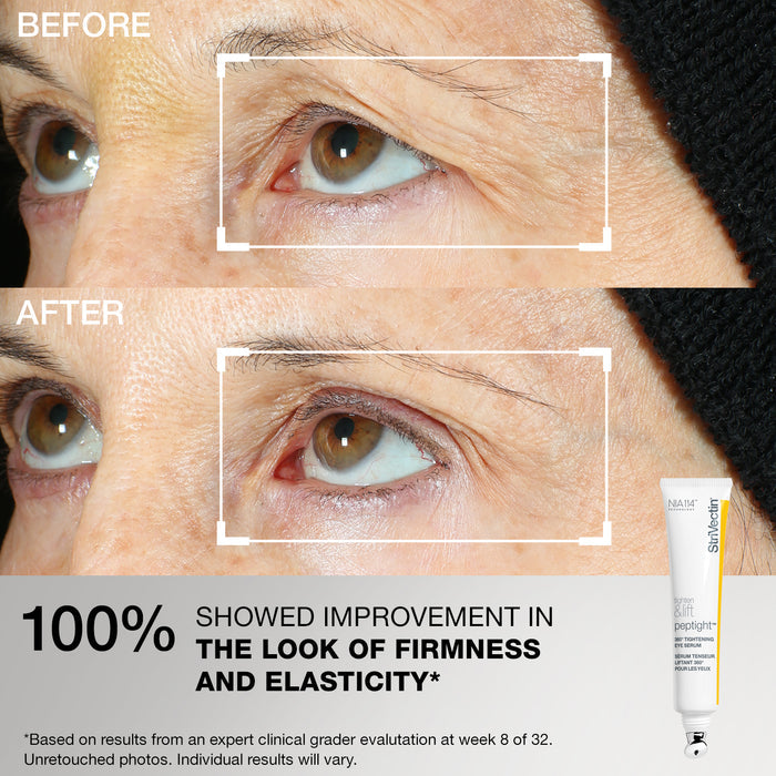 Tightening & Lifting: Peptide Routine