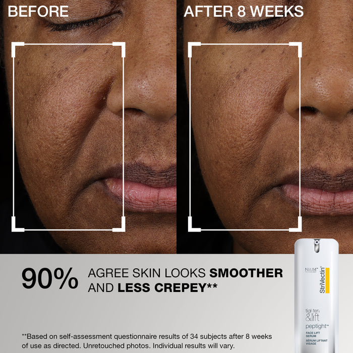 Tightening & Lifting: Peptide Routine