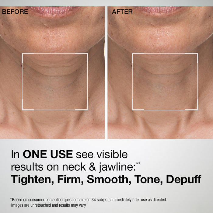 TL Advanced® Sculpting Neck & Jawline Mask